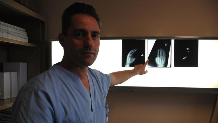 Il medico chirurgo Leone Pangallo che ha operato a Verona la vittima dell’infortunio alle quattro dita